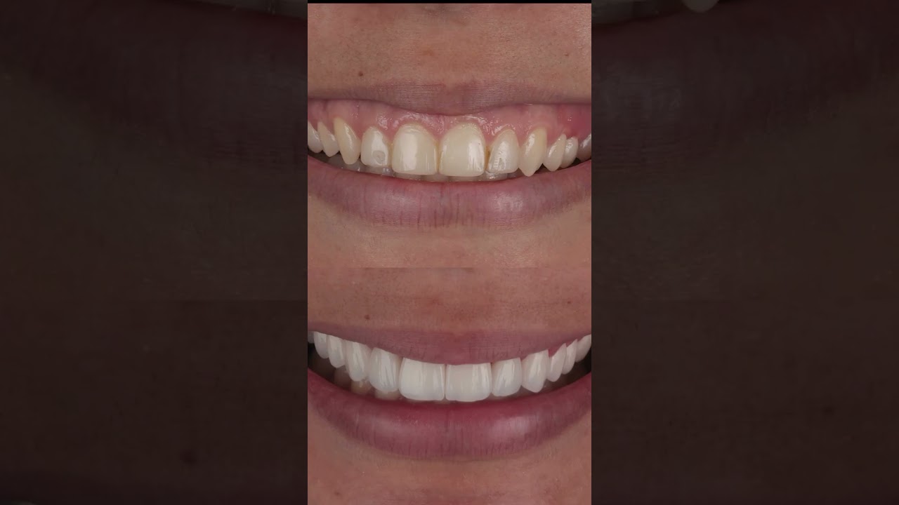 Frederico  Coelho-20