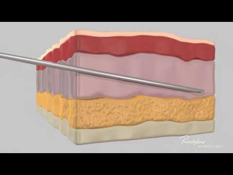 Restylane SkinBooster