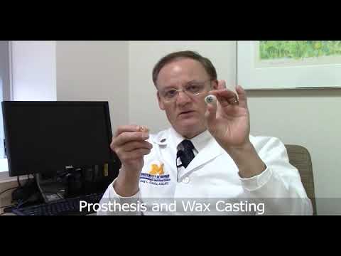 Ocular prosthetic / Prosthetic eye