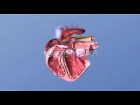 Sëmundjet e zemrës - Hipertensioni dhe infarkti më të përhapura