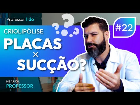mexplicaí #22 | Plates or Suction? 4 Frequently Asked Questions about Cryolipolysis | RentalMed