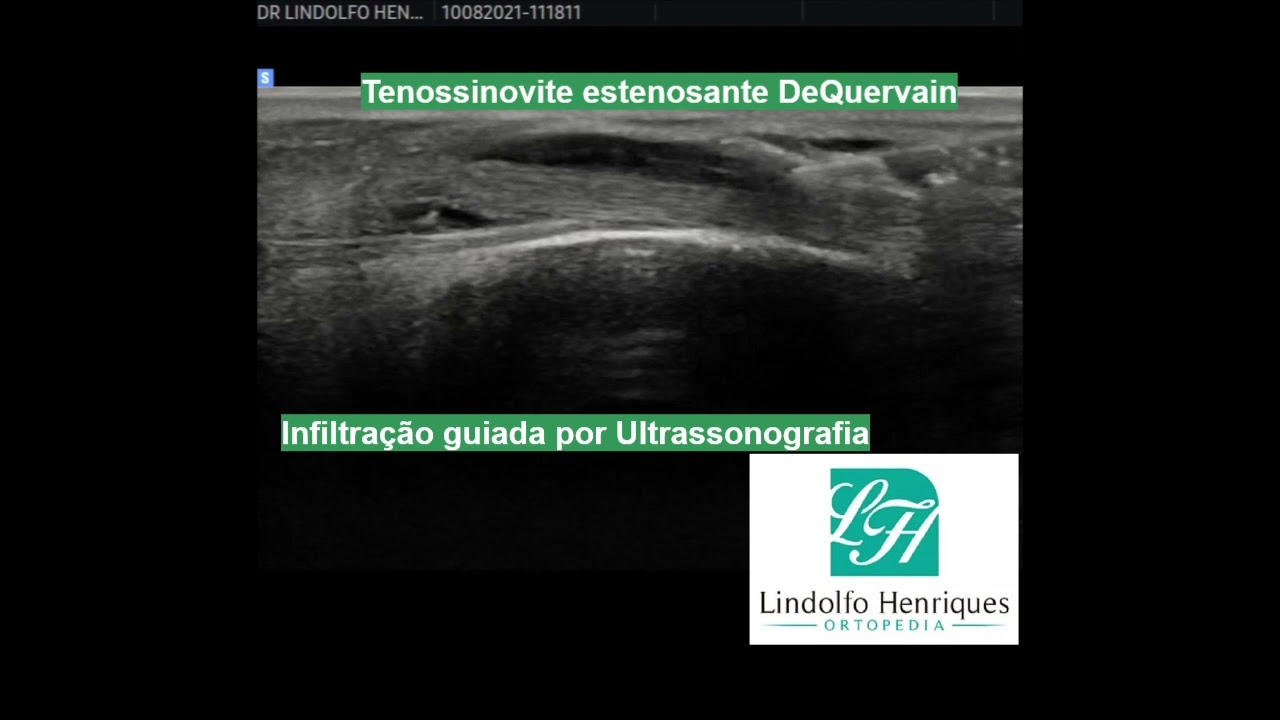 Lindolfo Henriques-15