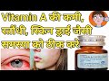 Aquasol A Capsules Aquasol A Capsule Use रतोंधी रोग आंखों में इ�
