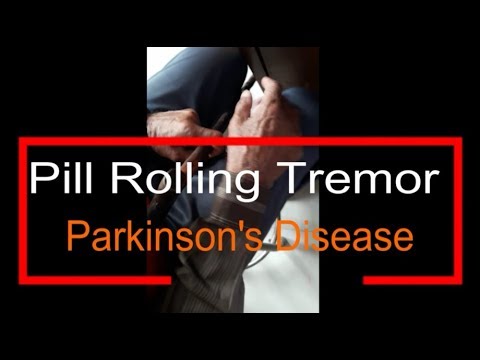 Pill Rolling Tremor - Parkinson's Disease
