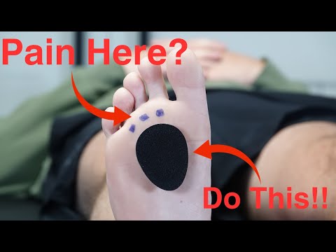 Metatarsalgia and Morton s Neuroma Evaluation and Treatment