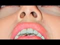 Actress Suhana Khan Unseen Nose And Lips Closeup Ultra Zoom