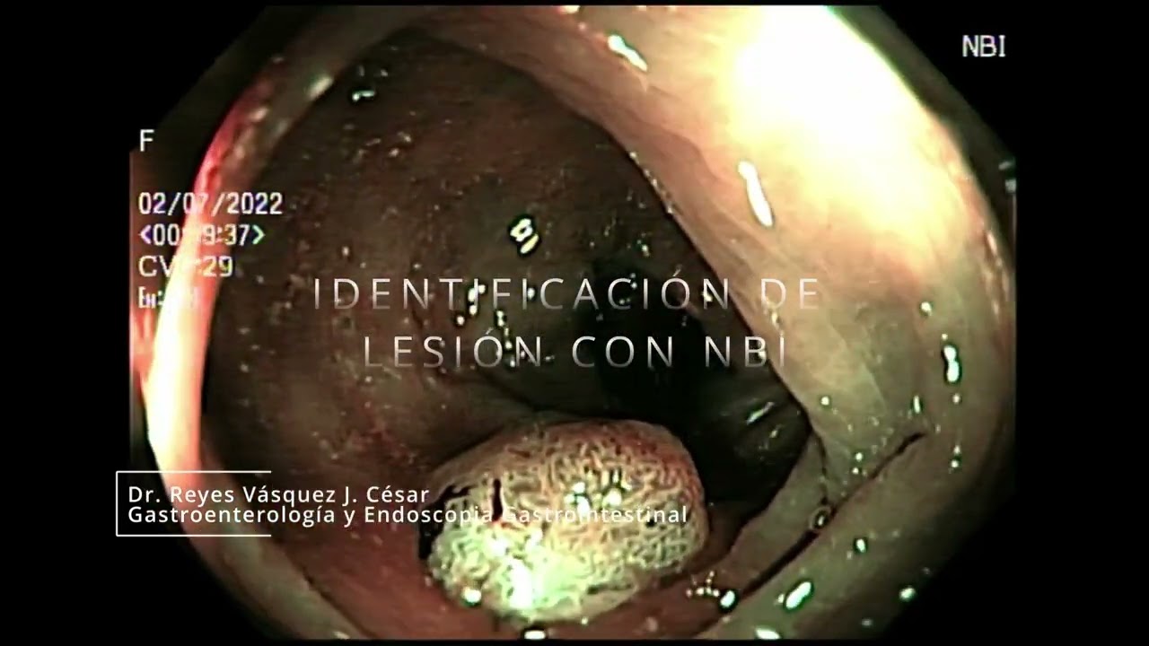 J. César Reyes Vásquez-42