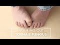 Figuring Out Toe Nail Fungus Dr Reza Mobarak Top10MD