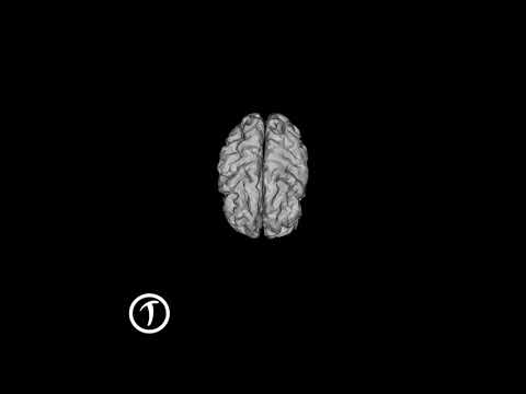 Traumatic - Mindgames (prod. Screwaholic)