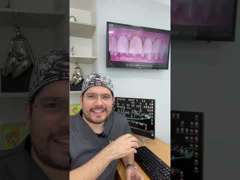 video MSyqkXm5cdw