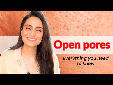 Open pores| How to treat | Creams to use | Lasers  | Dermatologist| Dr Aanchal