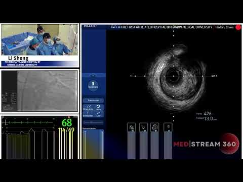 IVUS-Guided PCI of LM Bifurcation