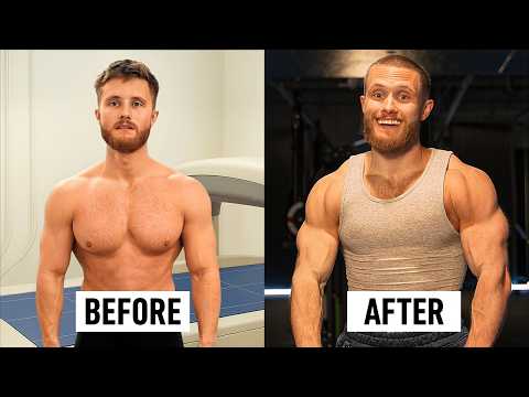 How I Blew Up My Shoulders