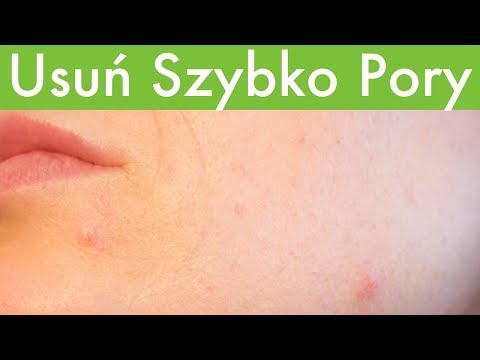 Witamina B1, B5 włosy Najlepszy olej do włosów miękkich