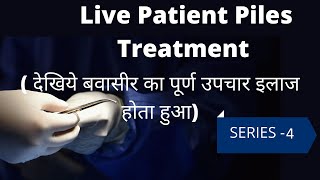 Piles Treatment || Live Patient Piles Treatment No. 4 || (Bawaseer ka ilaj) | Anti Piles ||