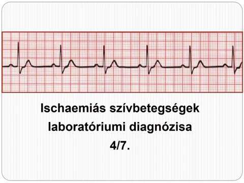 Az iszkémiás szívbetegség így előzhető meg