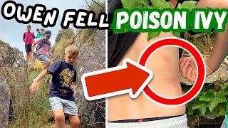 Owen Fell Backwards Into Poison Ivy