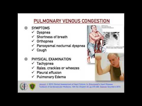 [UP Med Webinars] Congestive Heart Failure