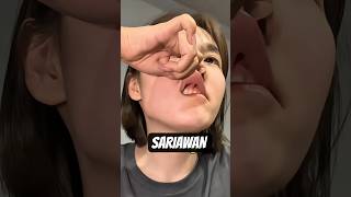 Download lagu Karena Sariawan Cewek Ini Susah Makan #shortviral #viralvideo #lucu mp3 Download lagu Karena Sariawan Cewek Ini Susah Makan #shortviral #viralvideo #lucu mp3