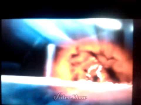 Los mejores momentos de claro como el dia