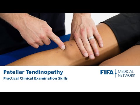 Boka tendinosis kezelése - tatraerembolt.hu