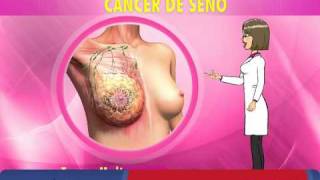 CANCER DE SENO