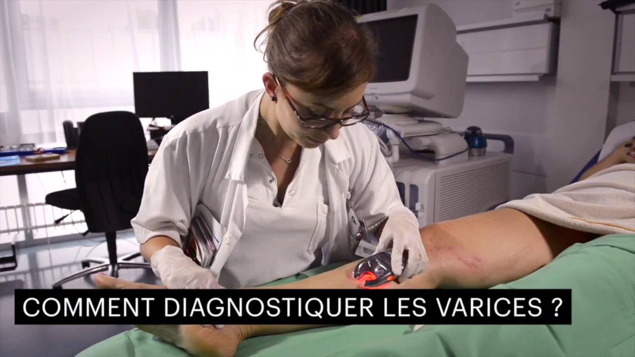 Les varices. Fréquentes mais pas anodines