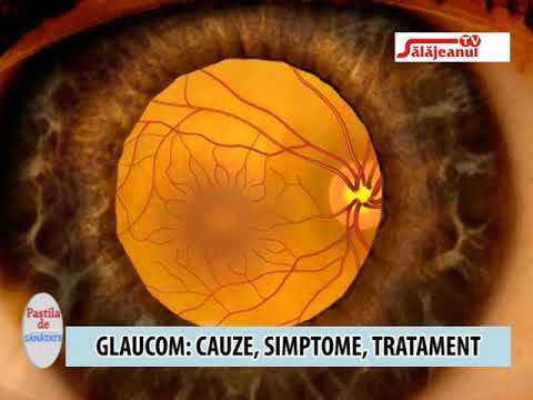 îmbunătățirea glaucomului vizual hipermetropie, congenitală sau dobândită