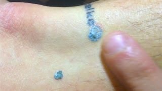 MY TATTOO CAME OFF!!