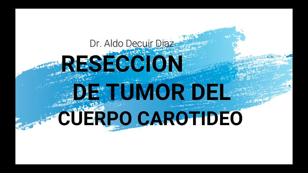 Aldo Decuir Díaz-172