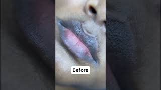 Dark lip neutralization NYC #pmu #permanentmakeup #pmutraining #nyc #permanentmakeuptraining
