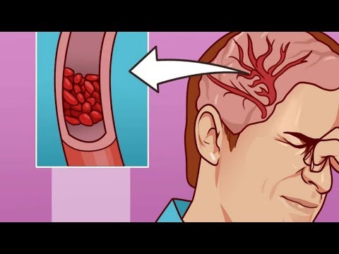 Krankenwagen hypertensive Renale Hypertonie Pathophysiologie