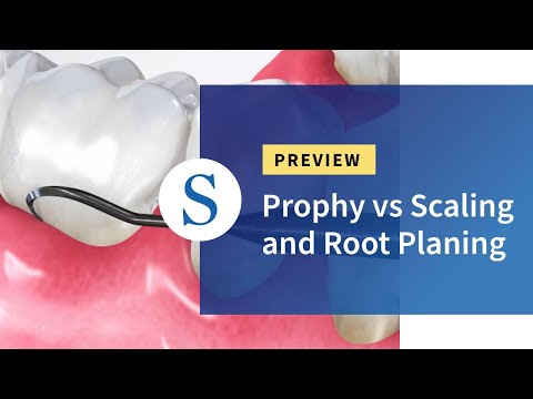 Prophy vs Scaling and Root Planing