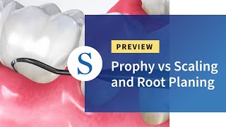 Prophy vs Scaling and Root Planing