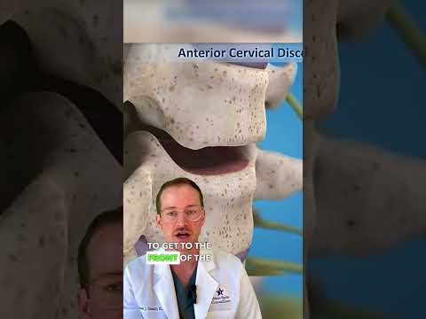 𝐍𝐞𝐜𝐤 𝐅𝐮𝐬𝐢𝐨𝐧 𝐒𝐮𝐫𝐠𝐞𝐫𝐲 (𝐀𝐧 𝐀𝐂𝐃𝐅!)✅