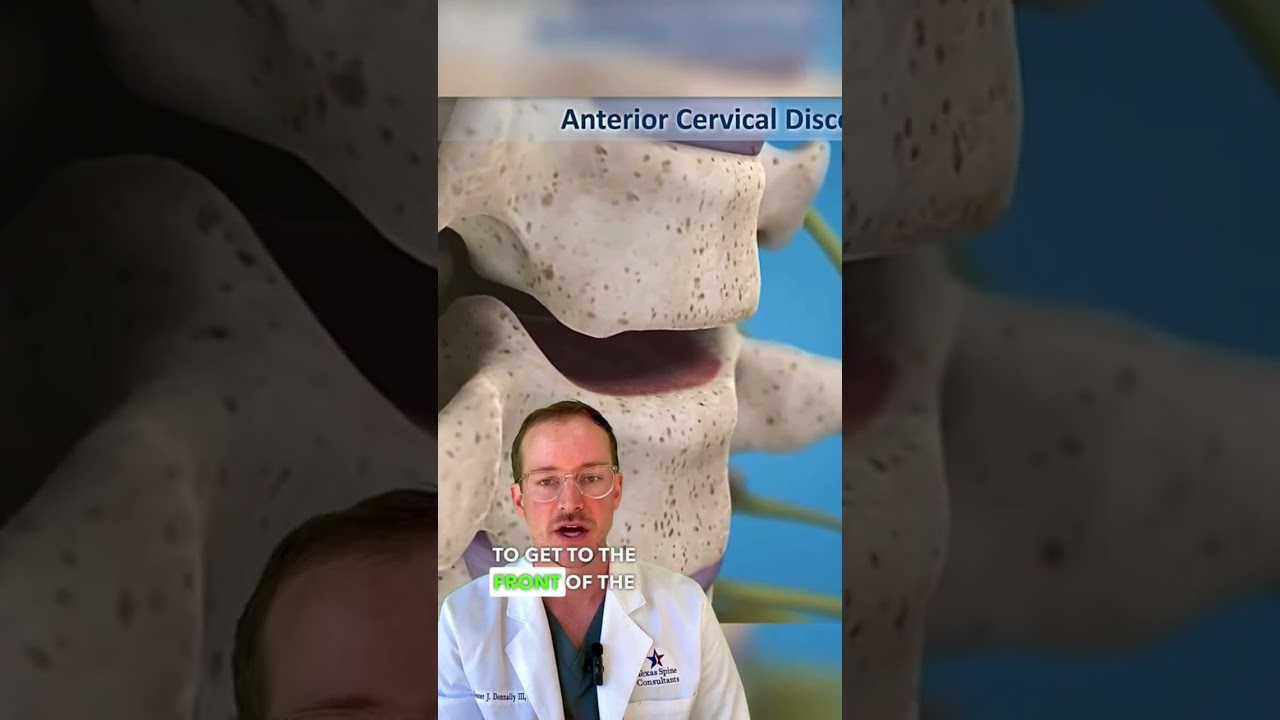 𝐍𝐞𝐜𝐤 𝐅𝐮𝐬𝐢𝐨𝐧 𝐒𝐮𝐫𝐠𝐞𝐫𝐲 (𝐀𝐧 𝐀𝐂𝐃𝐅!)✅