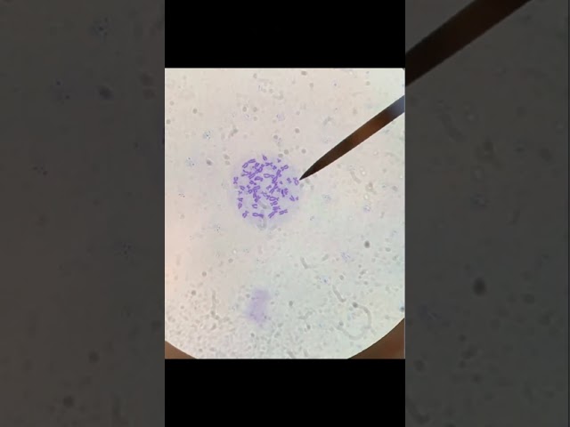 Vídeo relacionado con Poster Fotográfico Biologia, Ciencia, Cromosoma, Cadena ADN Azul Blanco Tamaño total: 131 x 62 cm XXL