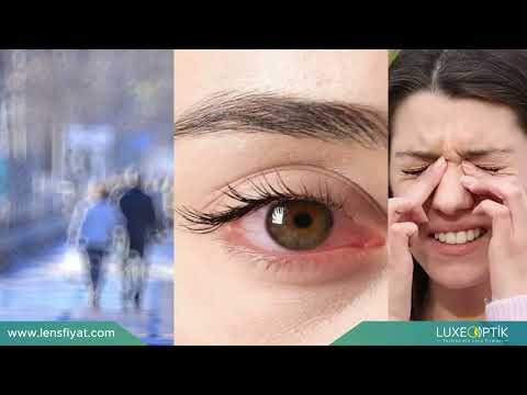 Kontakt Lensle Uyunur Mu?