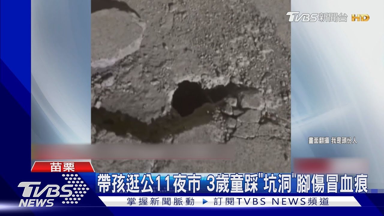 3歲孩童逛公11夜市　踩「坑洞」刮傷冒血痕