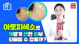 얼룩덜룩 아토피색소침착 없애는 법 전~부 알려드려요!