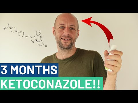 Ketoconazole Shampoo for Hair Loss - Our 3 Month Experiment!