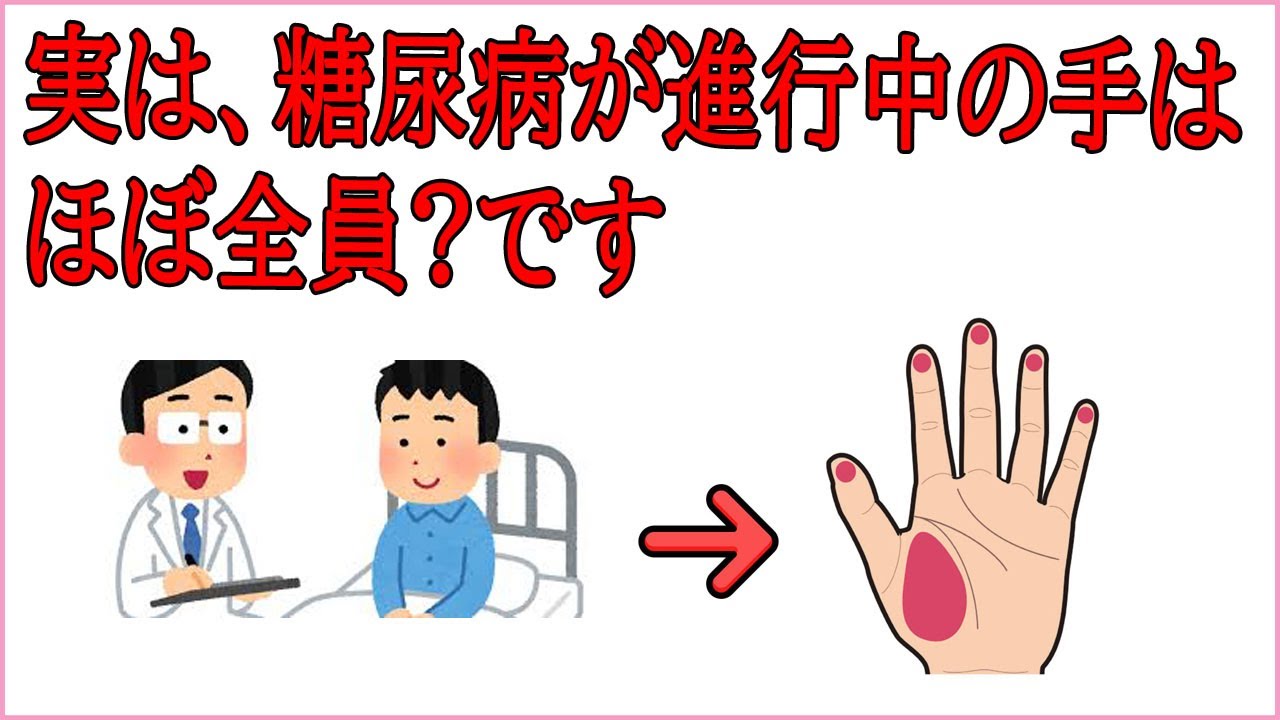 【誰かに教えたくなる健康雑学】実は糖尿病が進行中の手、ほぼ全員〇〇です---興味深い事実