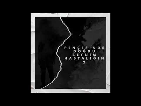 Ersel Ruyn - Pençesinde Doğdu Beynim Hastalığın 2