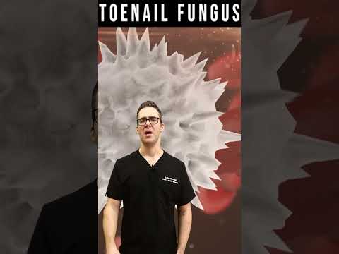 Skin Tag Removal Wart Removal How To Get Rid Of Skin Tags Warts