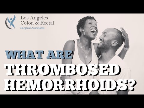 What Are Thrombosed Hemorrhoids YT