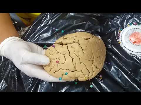 practica # 1 corteza , giros y surcos  parte 1