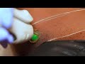 Brazilian Vagina Bikini Waxing Micro Bikini Intimate Waxing Tutorial Hairremoval Bikiniwax