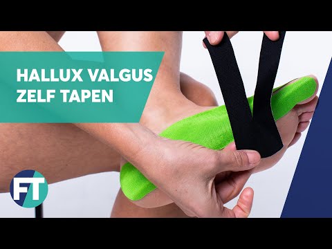Zelf Hallux valgus tapen » Instructie » FysioTape