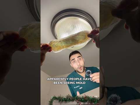 Do Always Pads Have Molds Inside?😮😮😮 (Doctor Explains)