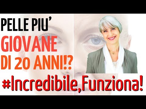 Xxx, rosso con lentiggini Decolorazione di pelle pigmentary posti